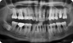 periodontics1 periodontics1