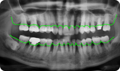 periodontics3