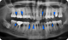 periodontics5 periodontics5
