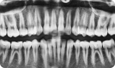 periodontics6