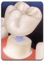 cap-dental cap-dental