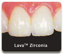 lava02 lava02
