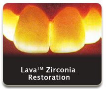lava04 lava04