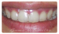 orthodontics01 orthodontics01