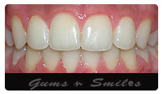 orthodontics04 orthodontics04