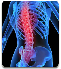 osteoporosis osteoporosis